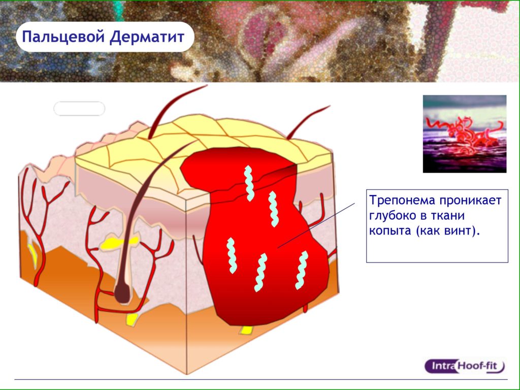 Intra Ванна