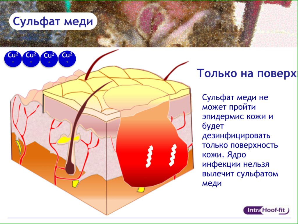 Intra Ванна