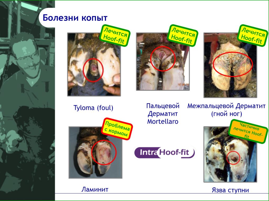Intra Ванна